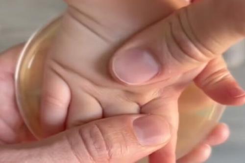 ویدئوی ترسناکی از دورهمی باکتری ها در کف دست یک کودک!
