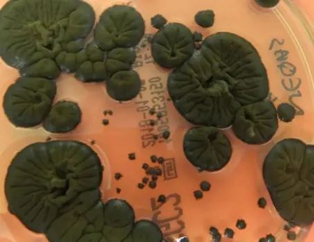 موجودی عجیب که خوراکش رادیواکتیو است!